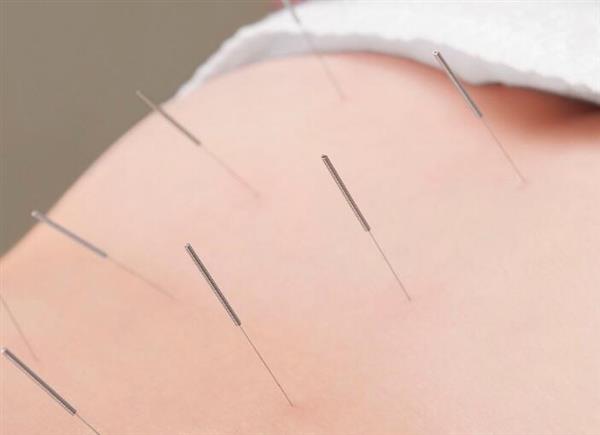 河北省郭氏按摩職業(yè)培訓(xùn)學(xué)校中醫(yī)針灸推拿專業(yè)培訓(xùn)班開課了嗎？