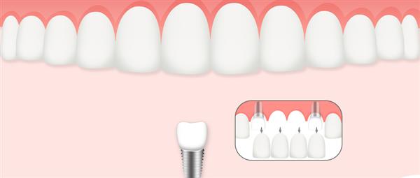 濟南口腔醫(yī)學(xué)專業(yè)學(xué)校是什么層次的學(xué)校？學(xué)校怎么樣？